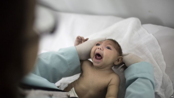 Գիտնականներն ուսումնասիրում են զիկա վիրուսի տարածման ուղին