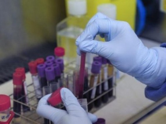 Կալիֆորնիա նահանգում հեպատիտ Ա-ի համաճարակի պատճառով արտակարգ իրավիճակ է հայտարարվել