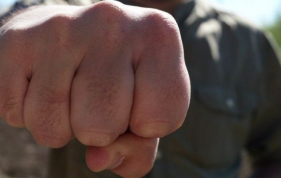 Դիտավորությամբ ծանր վնաս է պատճառել