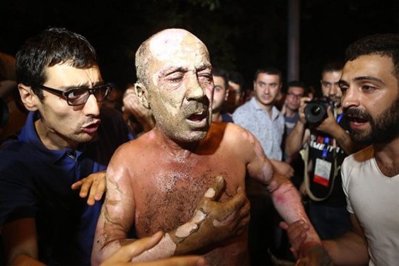 Ինքնահրկիզվողը հայտարարել էր, որ քաղաքական պատճառներով չի նման քայլ արել. նա թմրամոլ էր և ՁԻԱՀ-ով հիվանդ. բժիշկ