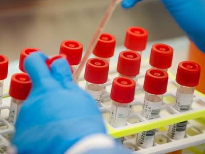 Минздрав Армении: Коронавирус выявлен у 1,5 % протестированных сотрудников школ
