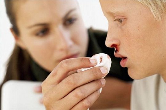 Ինչպես պայքարել քթի արյունահոսության դեմ