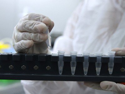 В Армении за сутки зарегистрировано 337 новых случаев заражения коронавирусом