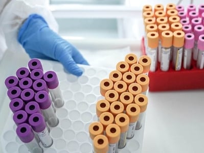 В Армении за сутки зарегистрировано 102 новых случая заражения коронавирусом