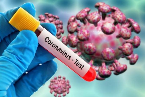 В Арцахе подтверждено 2 случая заражения COVID-19