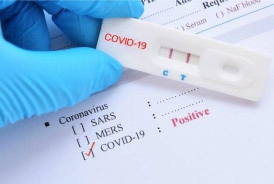 COVID-19: в Арцахе подтверждено 4 новых случая, 3 человека в тяжелом состоянии