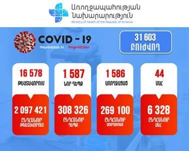 Հայաստանում հաստատվել է կորոնավիրուսով վարակվելու 1587 նոր դեպք. մահացել է 44 քաղաքացի