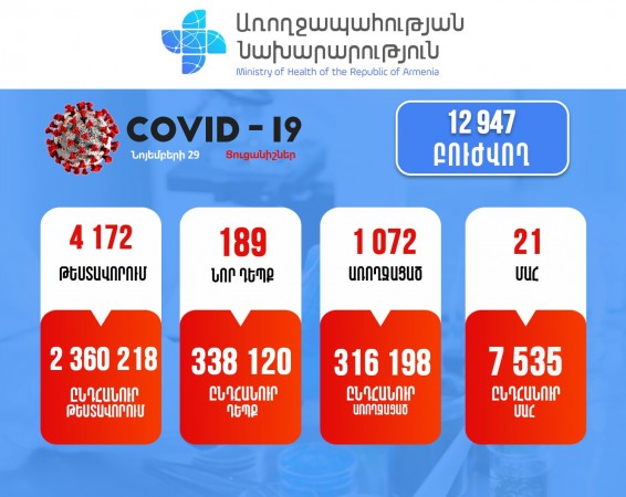 Կորոնավիրուսի 189 նոր դեպք, առողջացել է 1072 հոգի, մահացել 21-ը