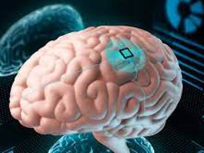 Իլոն Մասկի Neuralink-ը միկրոչիպեր կտեղադրի մարդկանց գանգերի մեջ եւ կստիպի ռոբոտներին ուղեղի վիրահատություն կատարել