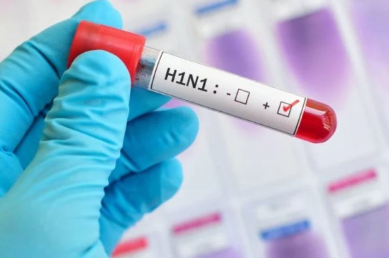 Штаммы H1N1 и H3N3 гриппа циркулируют в Армении – глава Минздрава