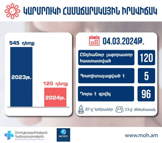 Հայաստանում 2023-ին արձանագրվել է կարմրուկի 545 դեպք, 2024-ին՝ արդեն իսկ 120 դեպք. 5-ը հոսպիտալացված են