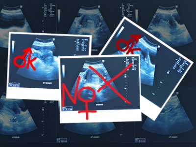 Հայաստանը աշխարհում 2-րդ տեղում է սելեկտիվ աբորտների ցուցանիշով