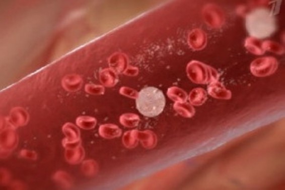 2016 թվականին Հայաստանում քաղցկեղի 8400 նոր դեպք է արձանագրվել