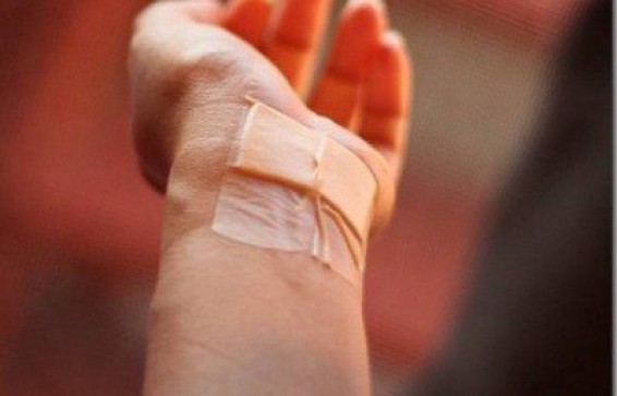 Երեւանում ամուսինը կնոջ հետ վիճելուց հետո ինքնավնասում է կատարել