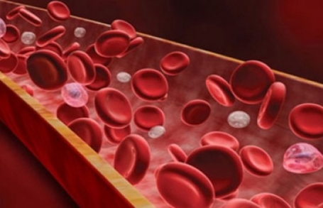 Մարդու հասակը՝ ռիսկային գործոն թրոմբոէմբոլիայի առաջացման համար